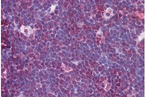 Human Thymus: Formalin-Fixed, Paraffin-Embedded (FFPE)