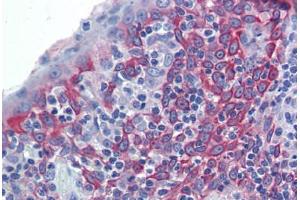 Human Tonsil (formalin-fixed, paraffin-embedded) stained with LIN7C antibody ABIN462236 followed by biotinylated goat anti-rabbit IgG secondary antibody ABIN481713, alkaline phosphatase-streptavidin and chromogen.