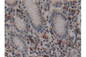 Detection of F13A1 in Human Stomach Tissue using Polyclonal Antibody to Coagulation Factor XIII A1 Polypeptide (F13A1)