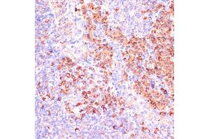Immunohistochemistry of paraffin-embedded mouse spleen using MZB1 antibody (ABIN7268403) at dilution of 1:100 (40x lens). (MZB1 anticorps  (AA 1-189))