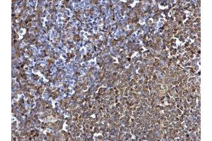 IHC-P Image SYK antibody [N2C2], Internal detects SYK protein at cytosol on rat spleen by immunohistochemical analysis.