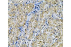 Immunohistochemistry of paraffin-embedded Mouse kidney using SERPINA6 Polyclonal Antibody at dilution of 1:100 (40x lens). (SERPINA6 anticorps)