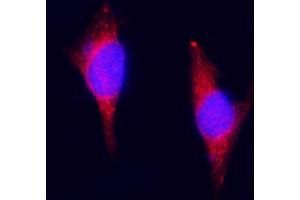 IF analysis of ZAC/Plagl1 using anti-ZAC/Plagl1 antibody (ABIN7599464). (PLAGL1 anticorps  (AA 1-527))