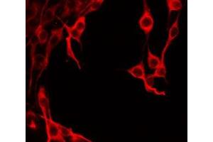 ABIN6277899 staining HeLa by IF/ICC.