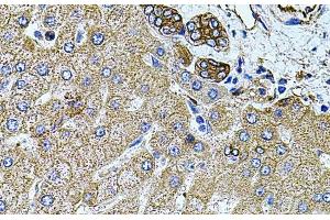 Immunohistochemistry of paraffin-embedded Human liver damage using FLNB Polyclonal Antibody at dilution of 1:100 (40x lens).