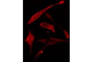 ABIN6274778 staining A549 cells by IF/ICC. (RPL30 anticorps  (C-Term))