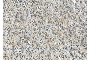 IHC analysis of SYP using anti-SYP antibody (ABIN7603120). (Synaptophysin anticorps  (N-Term))