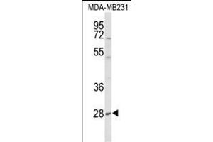 Western blot analysis of YIPF5 Antibody (N-term) (ABIN653506 and ABIN2842912) in MDA-M cell line lysates (35 μg/lane). (YIPF5 anticorps  (N-Term))