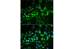 Immunofluorescence analysis of MCF-7 cells using TIMP2 antibody. (TIMP2 anticorps)