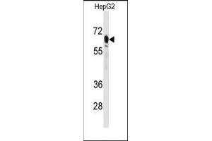Image no. 1 for anti-phosphoenolpyruvate Carboxykinase 2 (Mitochondrial) (PEPCK) (N-Term) antibody (ABIN360567) (PEPCK anticorps  (N-Term))