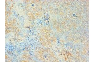 Immunohistochemistry of paraffin-embedded human tonsil tissue using ABIN7159650 at dilution of 1: 100 (AUH anticorps  (AA 68-339))