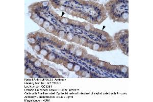Human Intestine (SMPDL3B anticorps  (N-Term))