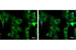 ICC/IF Image ACADM antibody detects ACADM protein at mitochondria by immunofluorescent analysis. (Medium-Chain Specific Acyl-CoA Dehydrogenase, Mitochondrial (MCAD) (C-Term) anticorps)
