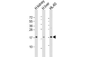 All lanes : Anti-FHIT Antibody (N-Term) at 1:2000 dilution Lane 1: human kidney lysate Lane 2: human liver lysate Lane 3: HL-60 whole cell lysate Lysates/proteins at 20 μg per lane. (FHIT anticorps  (AA 19-54))