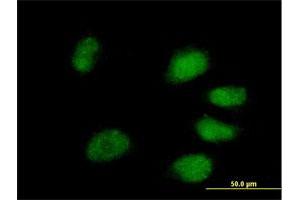 Immunofluorescence of purified MaxPab antibody to PPIL4 on HeLa cell. (PPIL4 anticorps  (AA 1-492))
