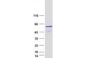 Validation with Western Blot
