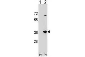 Western blot analysis of SULT1B1 (arrow) using rabbit polyclonal SULT1B1 Antibody (C-term) .