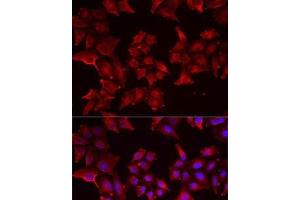 Immunofluorescence analysis of MCF7 cells using PCBD1 Polyclonal Antibody (PCBD1 anticorps)