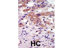 Immunohistochemistry (IHC) image for anti-Ribosomal Protein S6 Kinase, 90kDa, Polypeptide 6 (RPS6KA6) antibody (ABIN3003591)