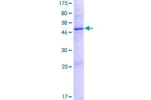 Image no. 1 for Patched Domain Containing 1 (PTCHD1) (AA 1-256) protein (GST tag) (ABIN1316706)