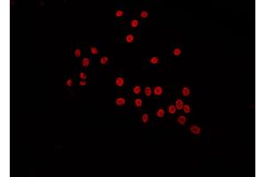 ABIN6272529 staining Hela by IF/ICC. (LARP1B anticorps  (Internal Region))