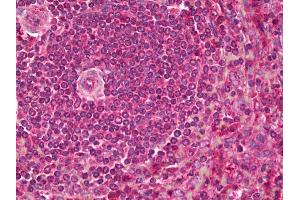 Anti-PCSK9 antibody IHC of human spleen. (PCSK9 anticorps)