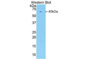 Western Blotting (WB) image for anti-Endothelial Cell-Specific Molecule 1 (ESM1) (AA 22-184) antibody (ABIN1858741) (ESM1 anticorps  (AA 22-184))