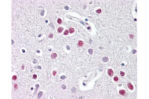 Anti-NR1D1 antibody IHC of human brain, cortex.