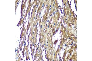 Immunohistochemistry of paraffin-embedded Mouse heart using NDUF Rabbit pAb (ABIN7268807) at dilution of 1:100 (40x lens).