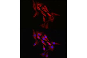 Immunofluorescence analysis of NIH/3T3 cells using α-Tubulin Rabbit mAb (ABIN7271036) at dilution of 1:100 (40x lens). (TUBA4A anticorps)
