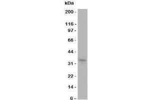 Western blot testing of Aquaporin 10 antibody and COLO320 cell lysate (Aquaporin 10 anticorps  (C-Term))