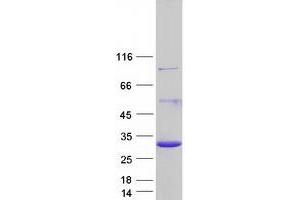 Validation with Western Blot