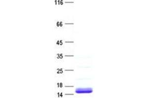 Validation with Western Blot (MRPL22 Protein (His tag))