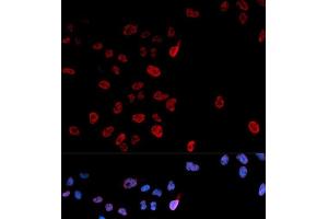 Immunofluorescence analysis of U2OS cells using Phospho-MYC(S62) Polyclonal Antibody (c-MYC anticorps  (pSer62))