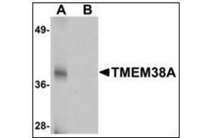 Western blot analysis of TMEM38A in rat skeletal muscle tissue lysate with TMEM38A antibody at 1 µg/ml in (A) the absence and (B) the presence of blocking peptide. (TMEM38A anticorps  (C-Term))