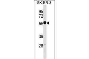 EEPD1 Antibody (C-term) (ABIN1537333 and ABIN2849670) western blot analysis in SK-BR-3 cell line lysates (35 μg/lane). (EEPD1 anticorps  (C-Term))