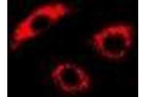 Immunofluorescent analysis of PDK4 staining in U2OS cells.