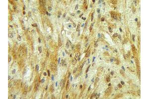 Image no. 1 for anti-Colony Stimulating Factor 3 (Granulocyte) (CSF3) antibody (ABIN465577)