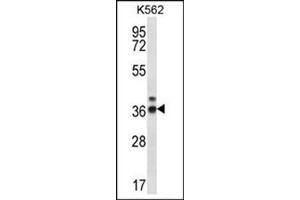 Western blot analysis of RPP38 Antibody (C-term) Cat. (RPP38 anticorps  (C-Term))