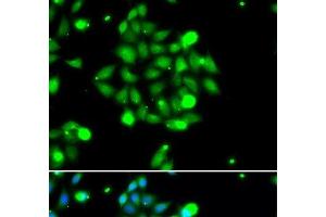 Immunofluorescence analysis of U2OS cells using UBE2G1 Polyclonal Antibody (UBE2G1 anticorps)