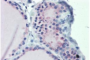 Thyroid, Human: Formalin-Fixed, Paraffin-Embedded (FFPE)