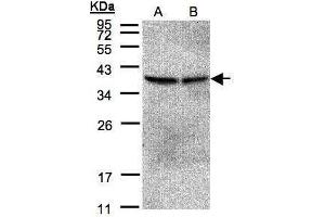 WB Image Sample(30 μg of whole cell lysate) A:293T B:A431, 12% SDS PAGE antibody diluted at 1:500 (PPP2CB anticorps  (Center))
