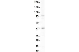 lane 1:  Mouse Spleen lysate    primary antibody dilution:  1:1000    secondary antibody:  goat anti-rabbit-HRP    secondary antibody dilution:  1:10,000    blocking buffer:  3% milk in TBST (NK2 Homeobox 3 anticorps  (N-Term))