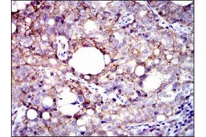 Immunohistochemistry (IHC) image for anti-Integrin beta 1 (ITGB1) antibody (ABIN1844058) (ITGB1 anticorps)