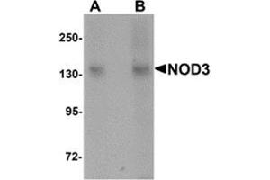 Western blot analysis of NOD3 in 3T3 cell lysate with NOD3 antibody at (A) 1 and (B) 2 μg/ml. (NLRC3 anticorps  (Center))