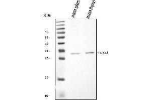 Western blot analysis of Dectin-1/Clec7a using anti-Dectin-1/Clec7a antibody (ABIN7600251).
