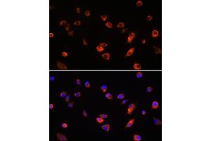Immunofluorescence analysis of L929 cells using B antibody (ABIN6130859, ABIN6137109, ABIN6137110 and ABIN6220869) at dilution of 1:100. (ARL13B anticorps  (AA 1-240))