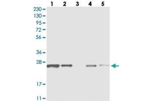 Western blot analysis of Lane 1: RT-4, Lane 2: U-251 MG, Lane 3: Human Plasma, Lane 4: Liver, Lane 5: Tonsil with C1orf52 polyclonal antibody  at 1:250-1:500 dilution. (C1ORF52 anticorps)