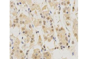 Immunohistochemistry of paraffin-embedded Human stomach using PSMB5 Polyclonal Antibody at dilution of 1:200 (40x lens). (PSMB5 anticorps)