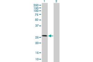 Western Blot analysis of KCNIP3 expression in transfected 293T cell line by KCNIP3 MaxPab polyclonal antibody. (DREAM anticorps  (AA 1-256))
